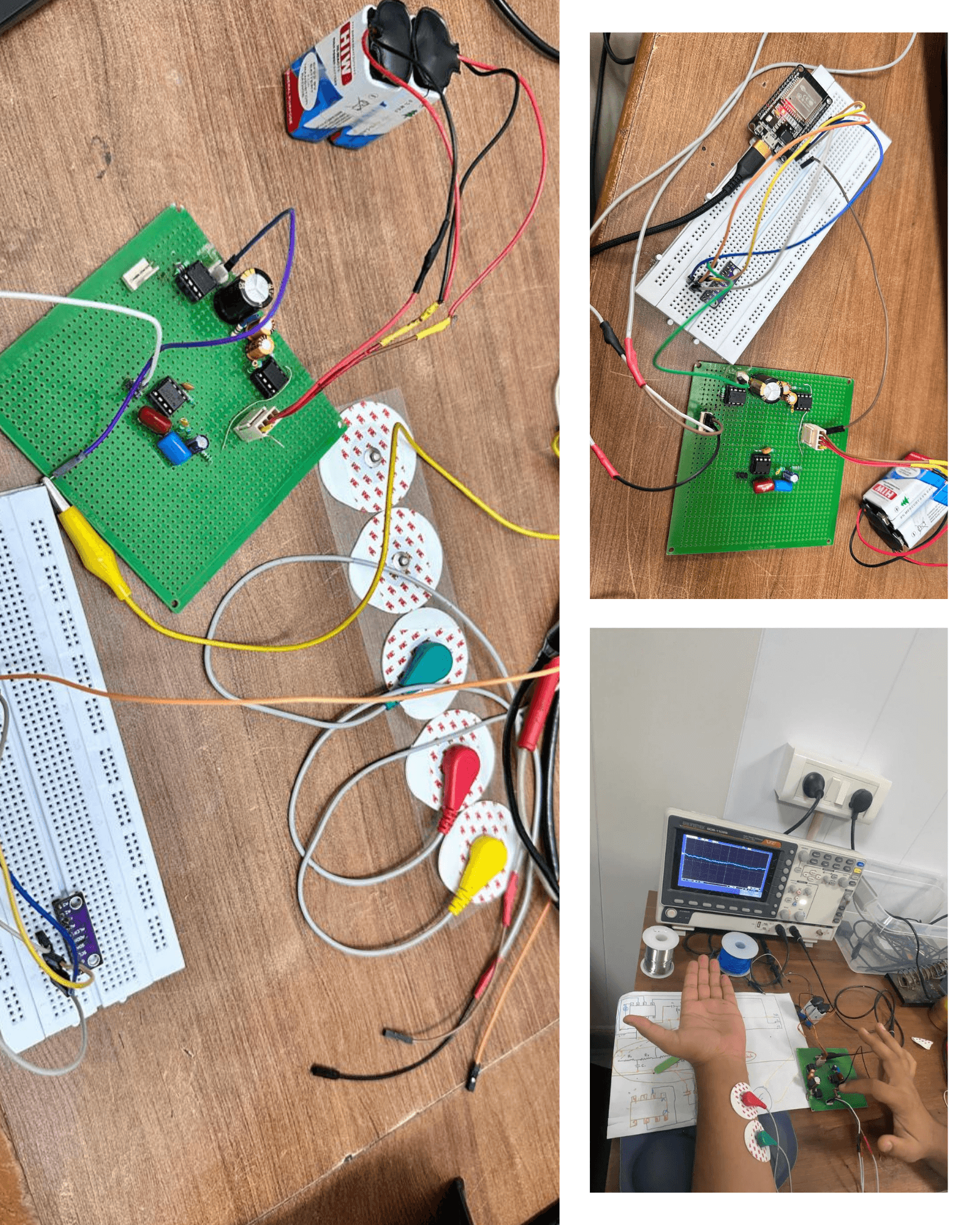 Electromyography (EMG) Detection Device screenshot